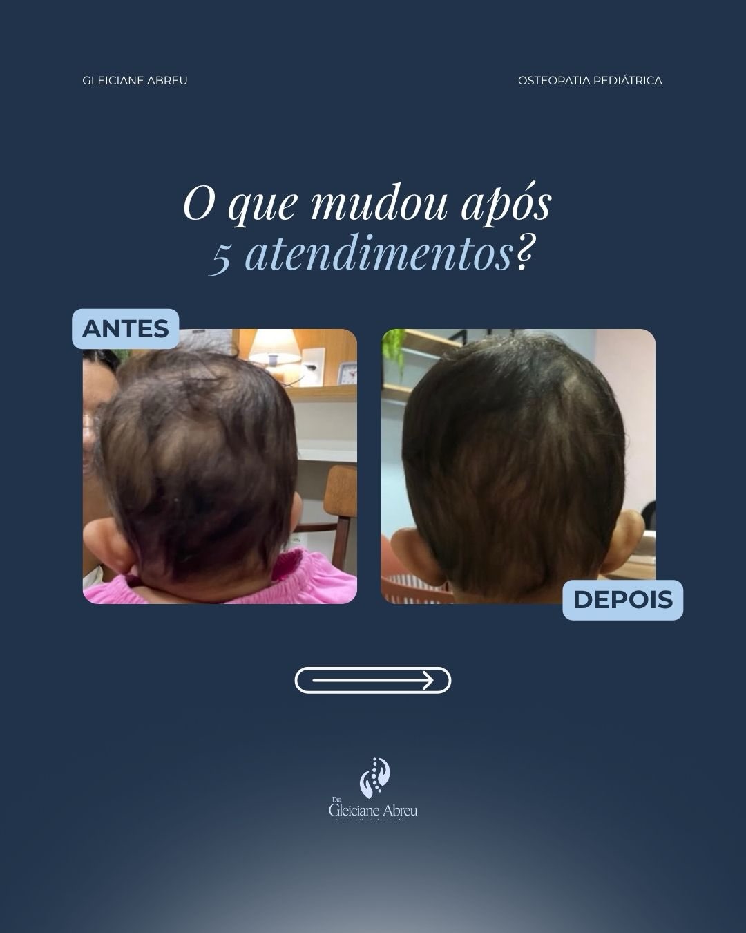 Arte com fotografias do formato da cabeça antes e depois de atendimentos